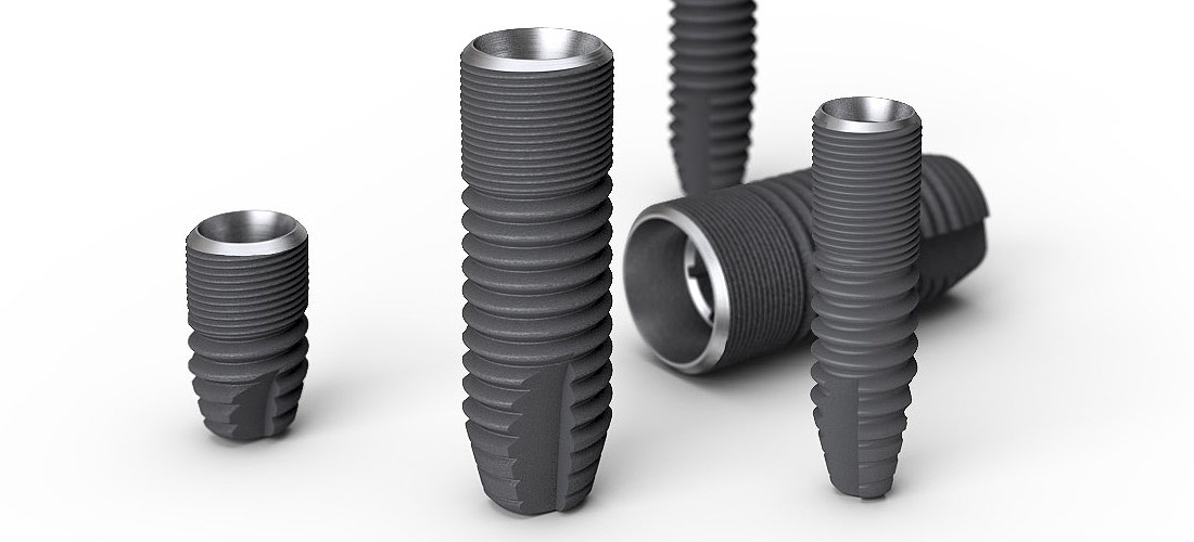 インプラント治療 | 京都、大阪のインプラント・矯正は、一元会松井